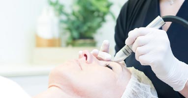 MICRODERMABRASIE - PEELING